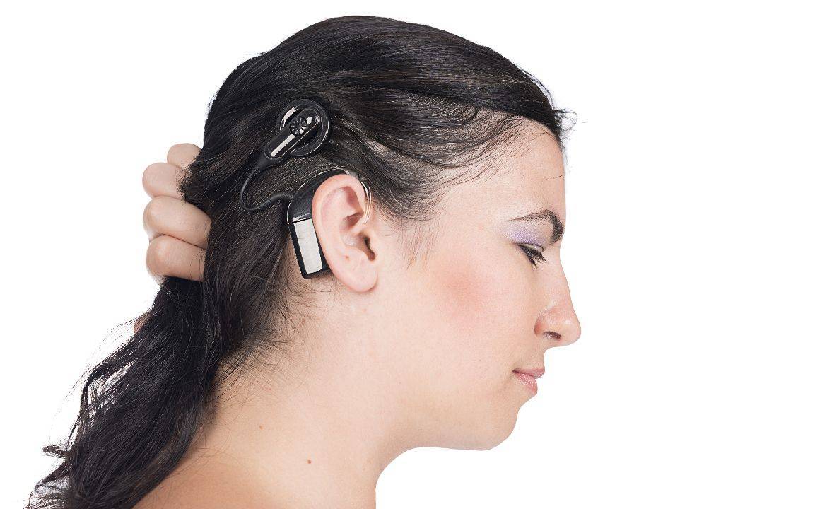 Mikor kaphatok hallásjavító implantátumot?